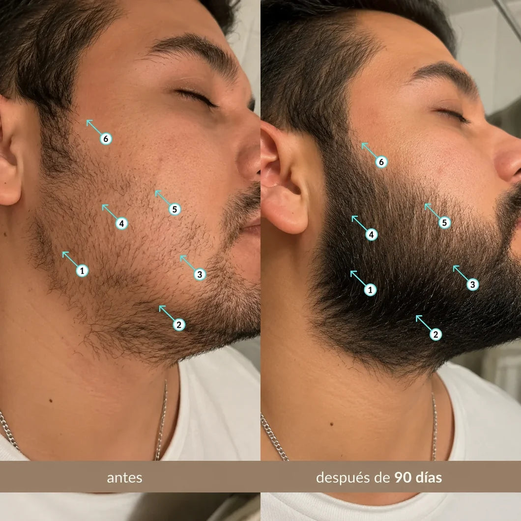 Spectral Men's™ Nanoxidil™ al 5%