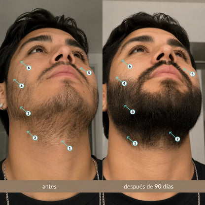Spectral Men's™ Nanoxidil™ al 5%